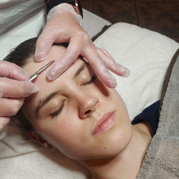 DERMAPLANING