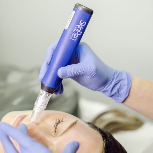 MICRONEEDLE (SMALL AREA)